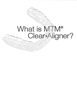 What is MTM Clear Aligner?